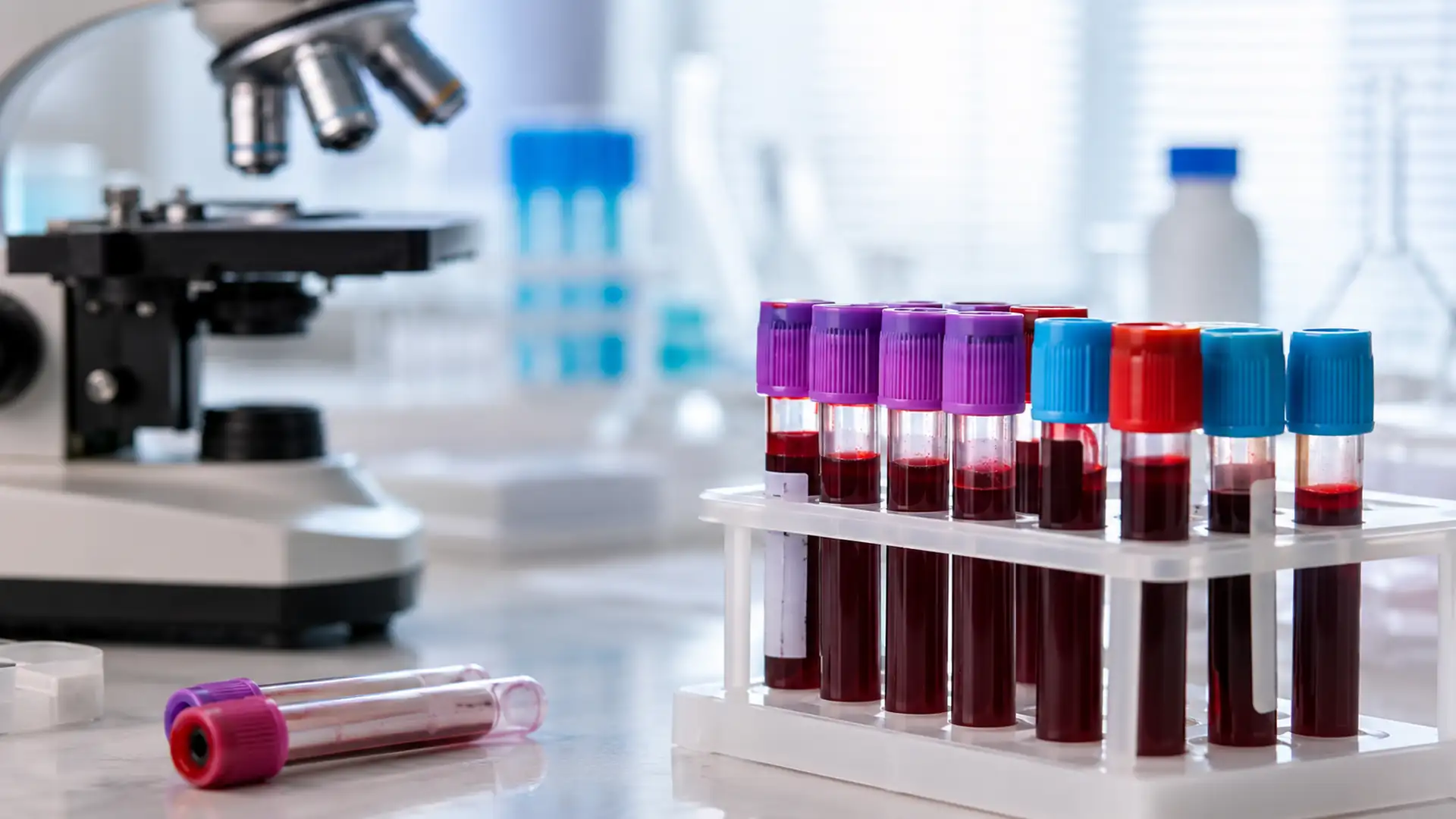 blood sample tubes arranged beside a microscope in a bright clinical laboratory for diagnostic testing