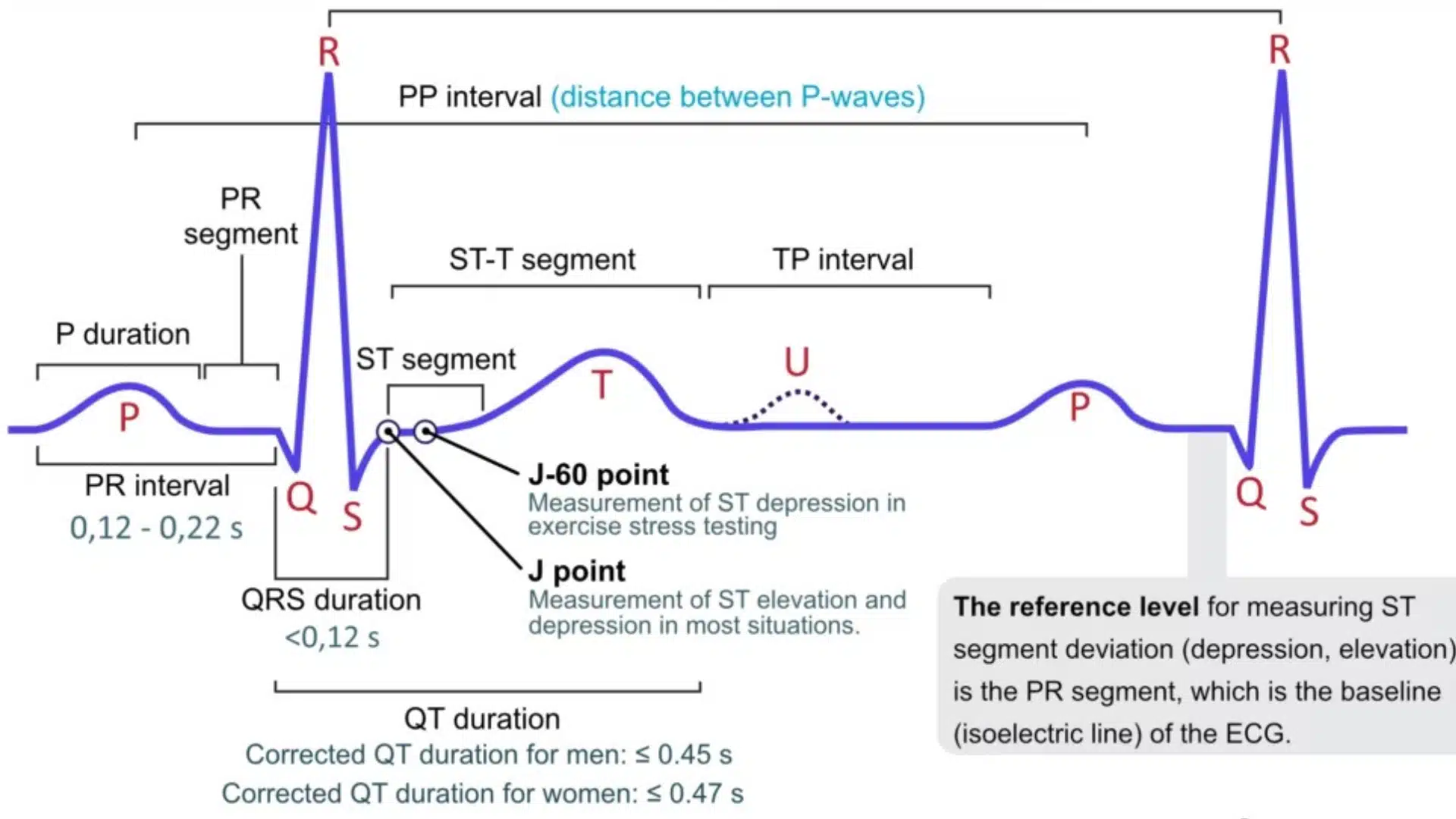 labeled ecg waveform diagram showing p wave qrs complex t wave and key intervals
