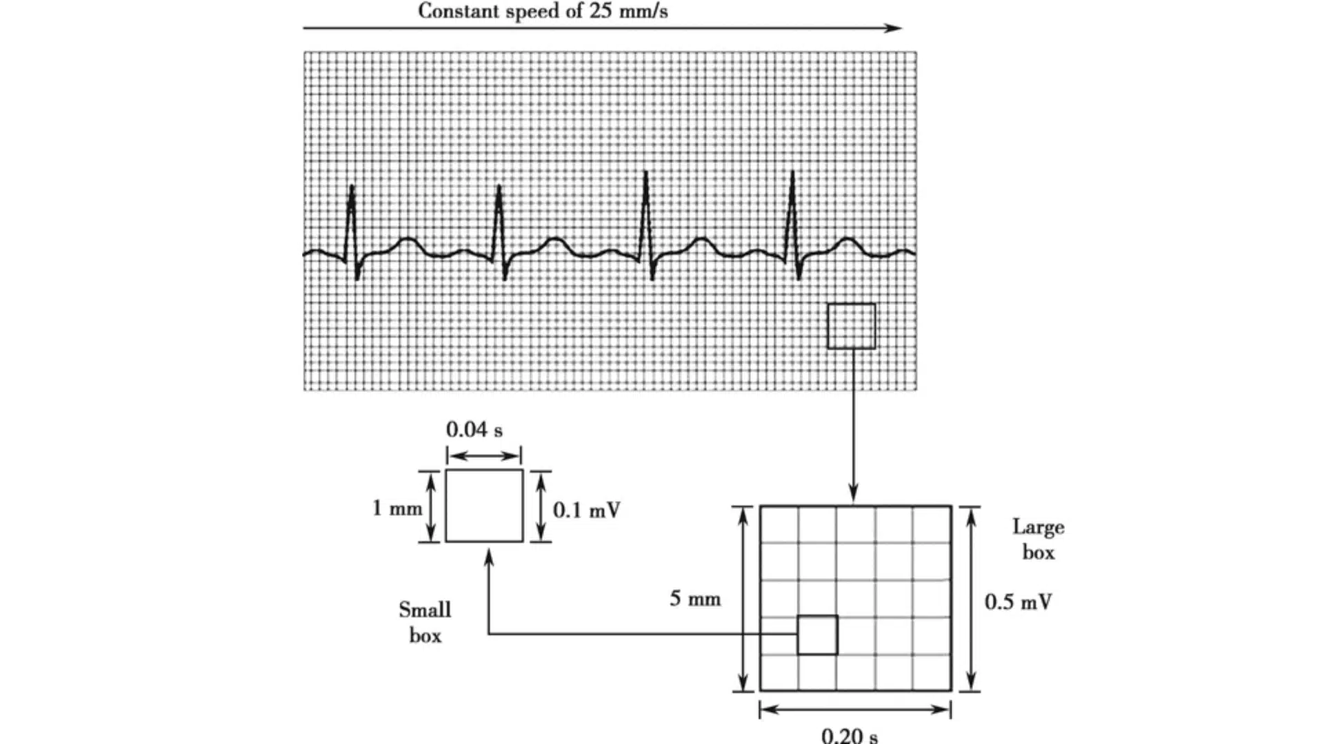 ecg grid diagram showing small and large box measurements in seconds and millivolts